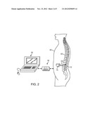 SYSTEM AND METHOD FOR ELECTRICAL MODULATION OF THE POSTERIOR LONGITUDINAL     LIGAMENT diagram and image