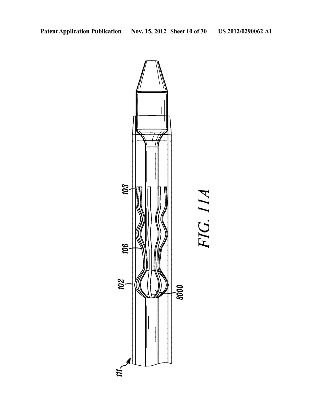 INTRA-ATRIAL IMPLANTS MADE OF NON-BRAIDED MATERIAL - diagram, schematic, and image 11