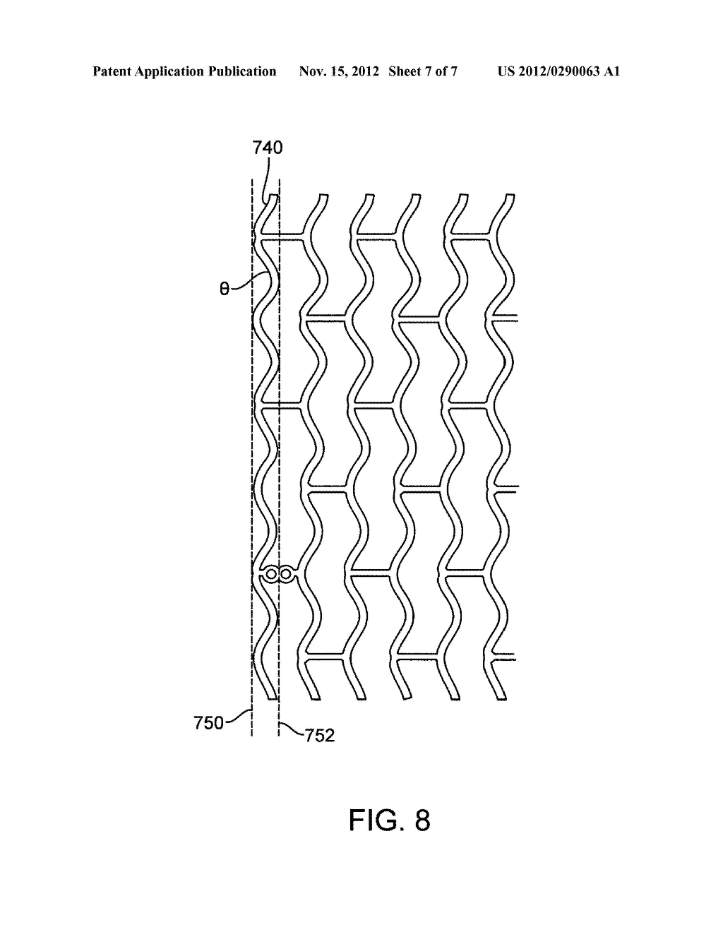 Method of Increasing Stent Retention of Bioabsorbable Scaffolding with a     Sheath - diagram, schematic, and image 08