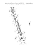 INTRODUCER WITH RATCHET HANDLE DRIVE diagram and image