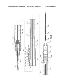 INTRODUCER WITH RATCHET HANDLE DRIVE diagram and image