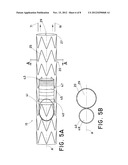 STEERABLE ILIAC BRANCH DEVICE diagram and image