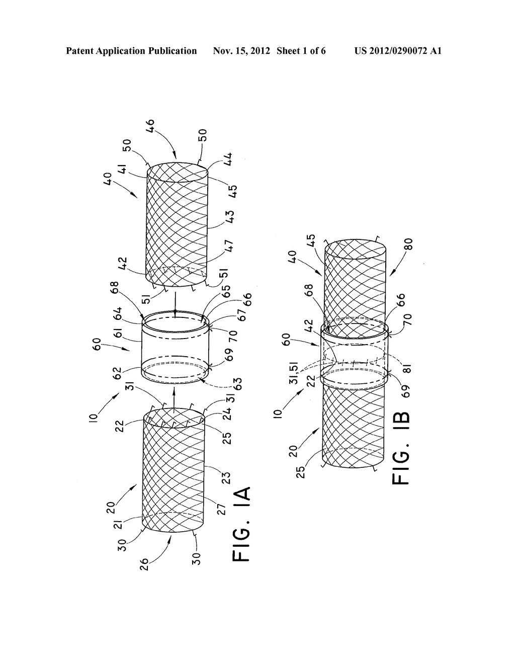 EMERGENCY VASCULAR REPAIR PROSTHESIS - diagram, schematic, and image 02