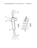 TISSUE RESTRAINING DEVICES AND METHODS OF USE diagram and image