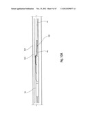 TISSUE RESTRAINING DEVICES AND METHODS OF USE diagram and image