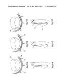 TISSUE RESTRAINING DEVICES AND METHODS OF USE diagram and image