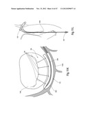 TISSUE RESTRAINING DEVICES AND METHODS OF USE diagram and image