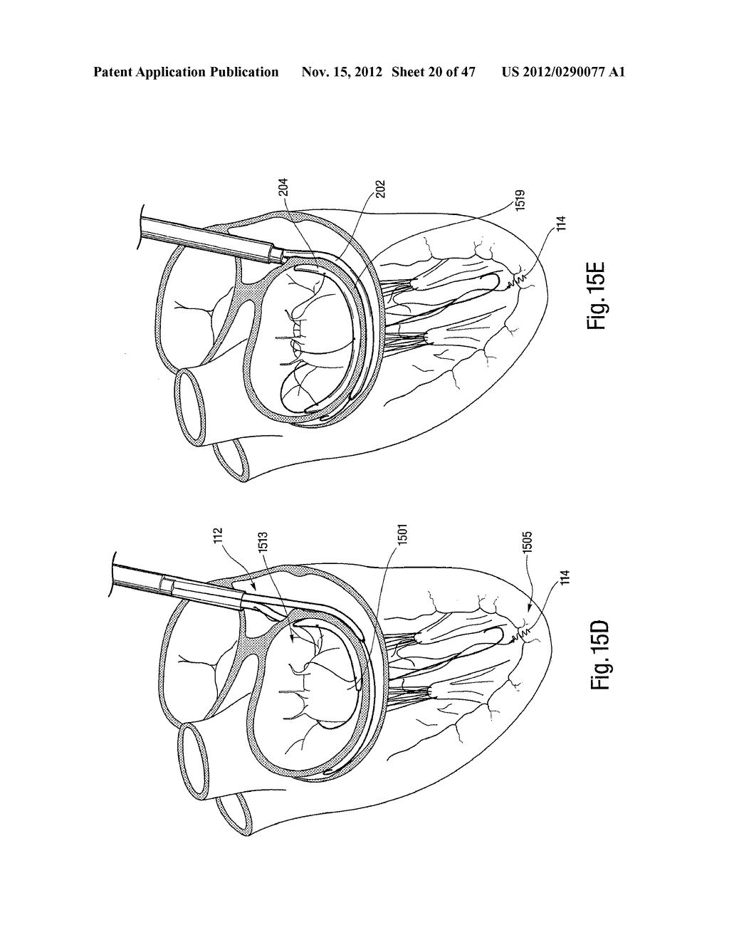 TISSUE RESTRAINING DEVICES AND METHODS OF USE - diagram, schematic, and image 21