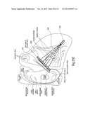 TISSUE RESTRAINING DEVICES AND METHODS OF USE diagram and image