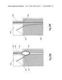 TISSUE RESTRAINING DEVICES AND METHODS OF USE diagram and image