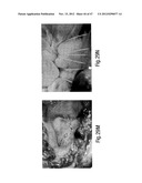 TISSUE RESTRAINING DEVICES AND METHODS OF USE diagram and image