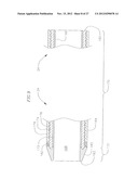 HEART VALVE DELIVERY SYSTEM WITH VALVE CATHETER diagram and image