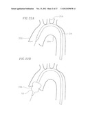 HEART VALVE DELIVERY SYSTEM WITH VALVE CATHETER diagram and image