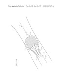 HEART VALVE DELIVERY SYSTEM WITH VALVE CATHETER diagram and image