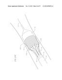 HEART VALVE DELIVERY SYSTEM WITH VALVE CATHETER diagram and image