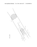 HEART VALVE DELIVERY SYSTEM WITH VALVE CATHETER diagram and image