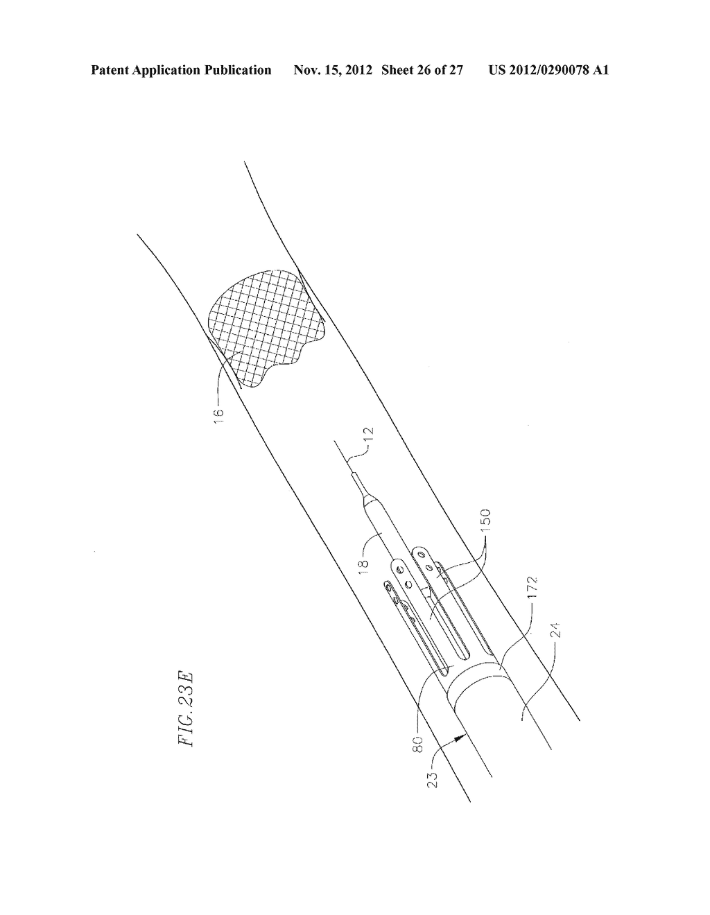 HEART VALVE DELIVERY SYSTEM WITH VALVE CATHETER - diagram, schematic, and image 27