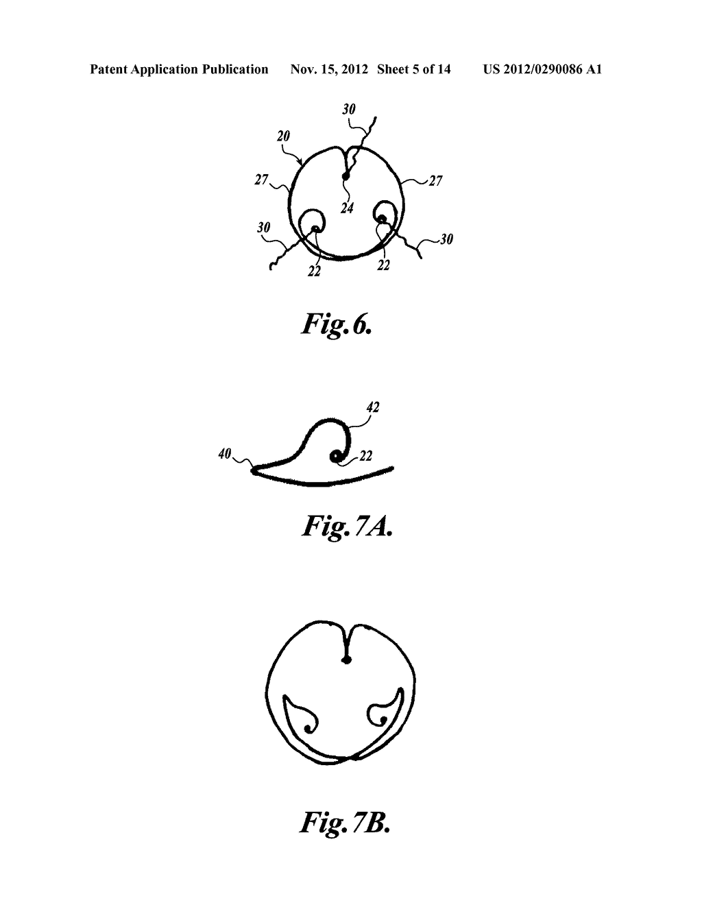 INTRAOCULAR CAPSULAR TENSION RINGS - diagram, schematic, and image 06