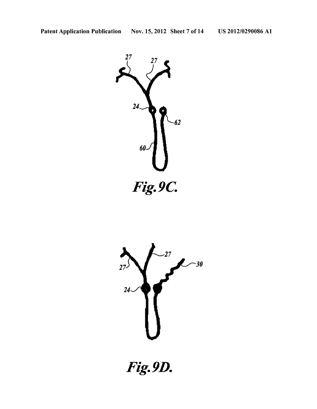 INTRAOCULAR CAPSULAR TENSION RINGS - diagram, schematic, and image 08