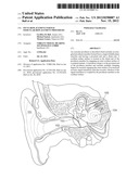 Incus Replacement Partial Ossicular Replacement Prosthesis diagram and image