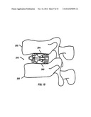 Expandable Fusion Device and Method of Installation Thereof diagram and image