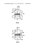 Expandable Fusion Device and Method of Installation Thereof diagram and image