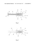 TISSUE PROSTHESIS AND A METHOD OF, AND EQUIPMENT FOR, FORMING A TISSUE     PROSTHESIS diagram and image