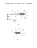 TISSUE PROSTHESIS AND A METHOD OF, AND EQUIPMENT FOR, FORMING A TISSUE     PROSTHESIS diagram and image