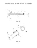 TISSUE PROSTHESIS AND A METHOD OF, AND EQUIPMENT FOR, FORMING A TISSUE     PROSTHESIS diagram and image