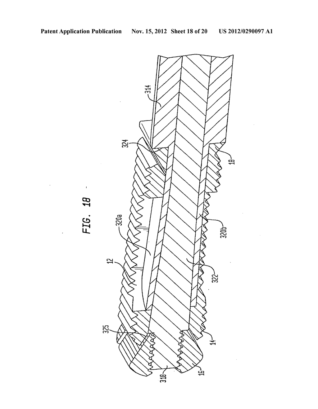 EXPANDABLE INTERVERTEBRAL IMPLANT - diagram, schematic, and image 19