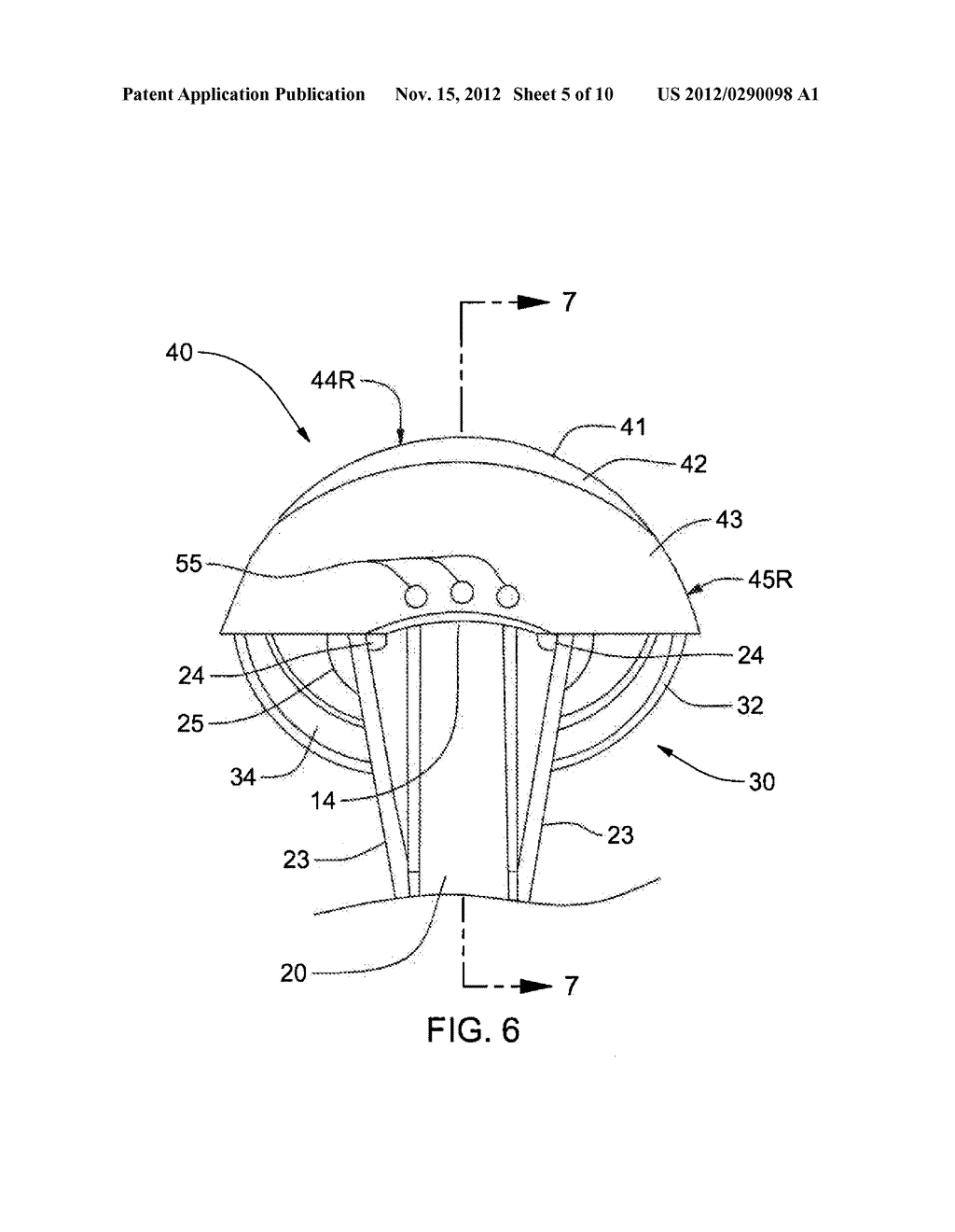 METHODS OF USING, PROVIDING AND MANUFACTURING A SHOULDER PROSTHESIS WITH A     ONE-PIECE HUMERAL HEAD - diagram, schematic, and image 06