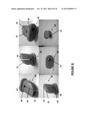 MINIMALLY INVASIVE SURGICAL TOOLS FOR HIP PROSTHESIS diagram and image