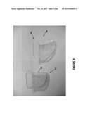 MINIMALLY INVASIVE SURGICAL TOOLS FOR HIP PROSTHESIS diagram and image