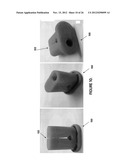 MINIMALLY INVASIVE SURGICAL TOOLS FOR HIP PROSTHESIS diagram and image