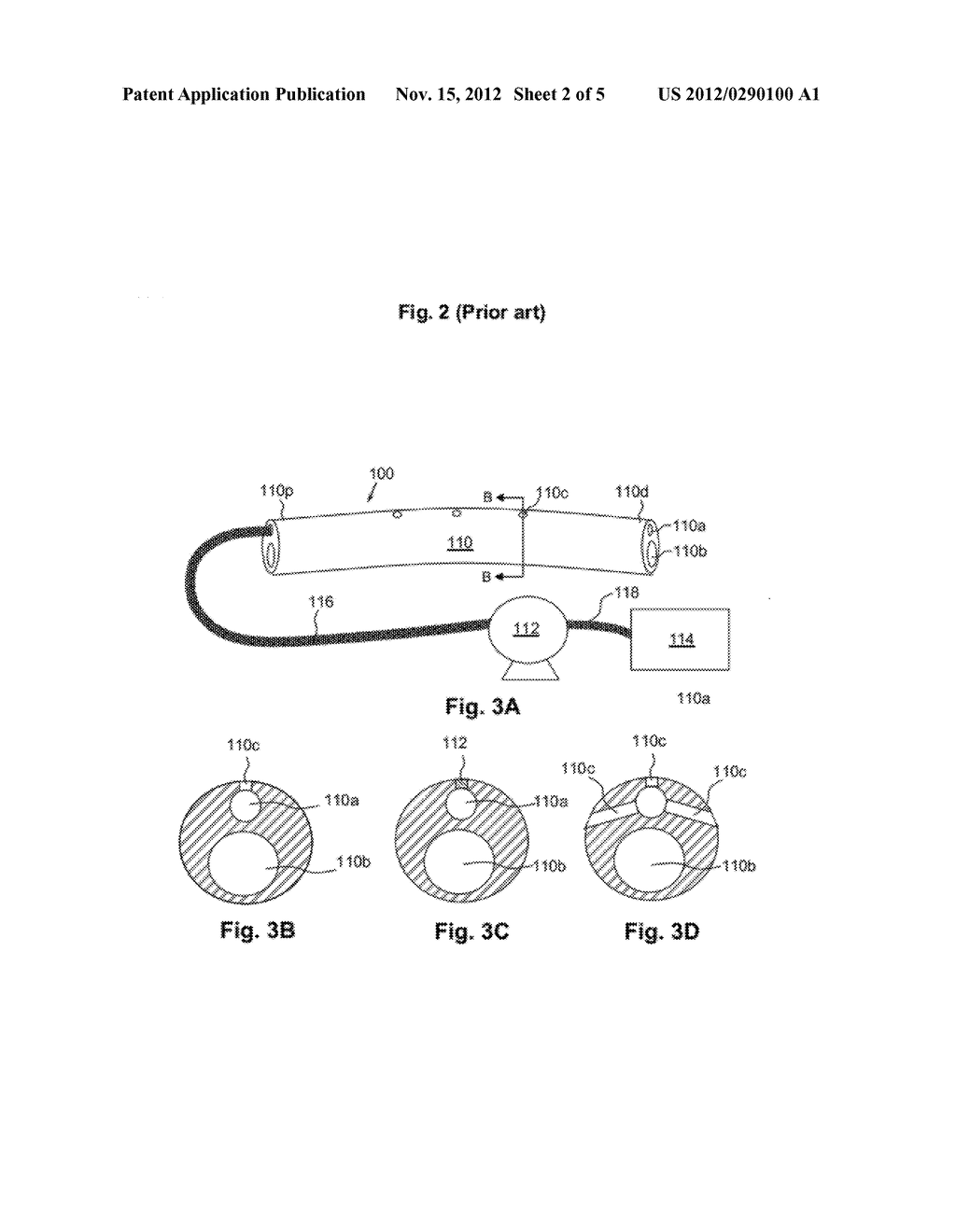 MEDICAL APPARATUSES FOR DELIVERY OF UROLOGICALLY BENEFICIAL AGENTS - diagram, schematic, and image 03