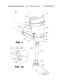 Knee Crutch System diagram and image