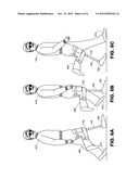 Knee Crutch System diagram and image