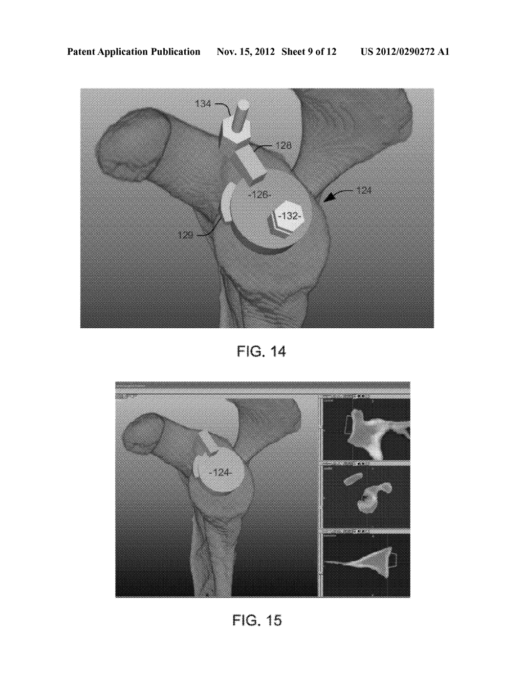 GENERATING PATIENT SPECIFIC INSTRUMENTS FOR USE AS SURGICAL AIDS - diagram, schematic, and image 10