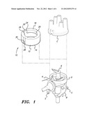 INTERNAL COMBUSTION ENGINE IGNITION TIMING TOOL diagram and image