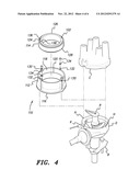 INTERNAL COMBUSTION ENGINE IGNITION TIMING TOOL diagram and image