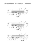 METHOD FOR PREPARING A CATHETER ASSEMBLY INCLUDING A SENSING ELEMENT     HAVING AN ADHESIVE BACKING diagram and image