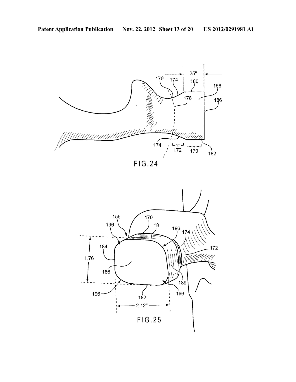 INTERLOCK FEATURE FOR RAILCAR CORES - diagram, schematic, and image 14