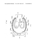 HORSE ORTHOTIC diagram and image