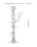 CIRCULAR STAPLING INSTRUMENT HAVING A BREAKAWAY WASHER ATTACHMENT MEMBER diagram and image