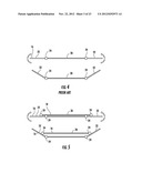 ADJUSTABLE HEAD REST diagram and image