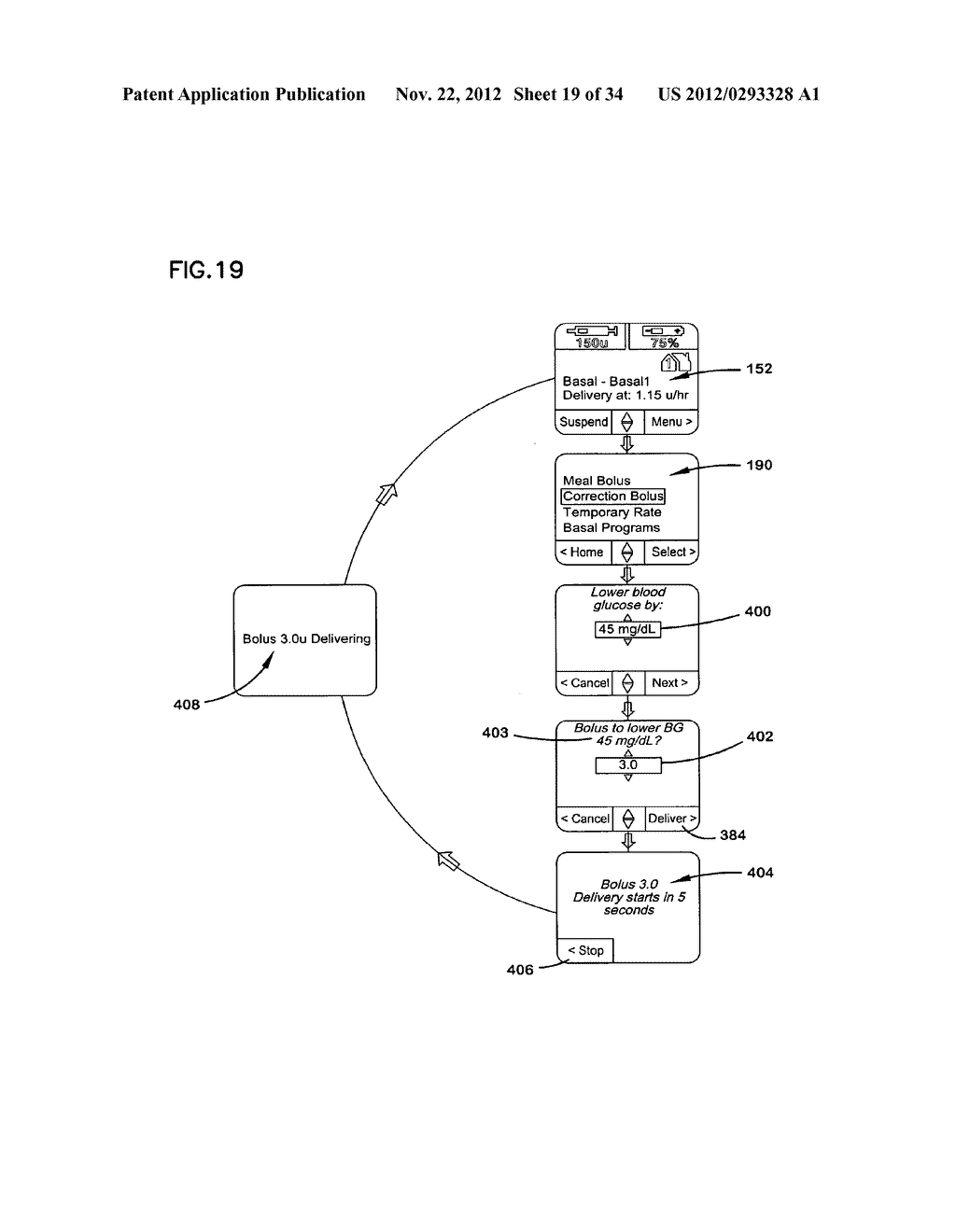 INSULIN PUMP HAVING AN ALARM SIGNAL - diagram, schematic, and image 20