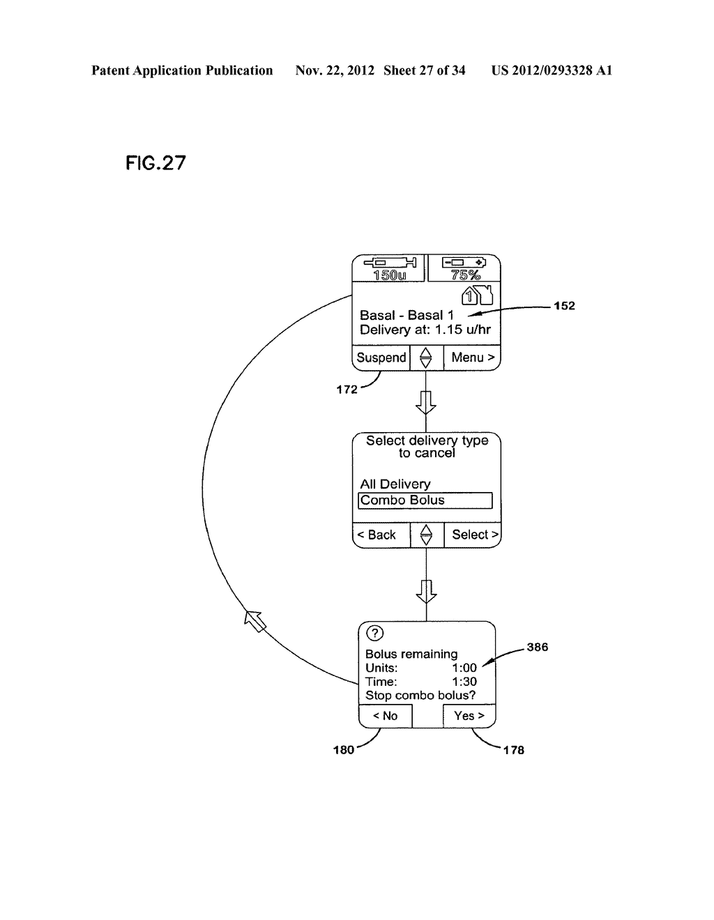 INSULIN PUMP HAVING AN ALARM SIGNAL - diagram, schematic, and image 28