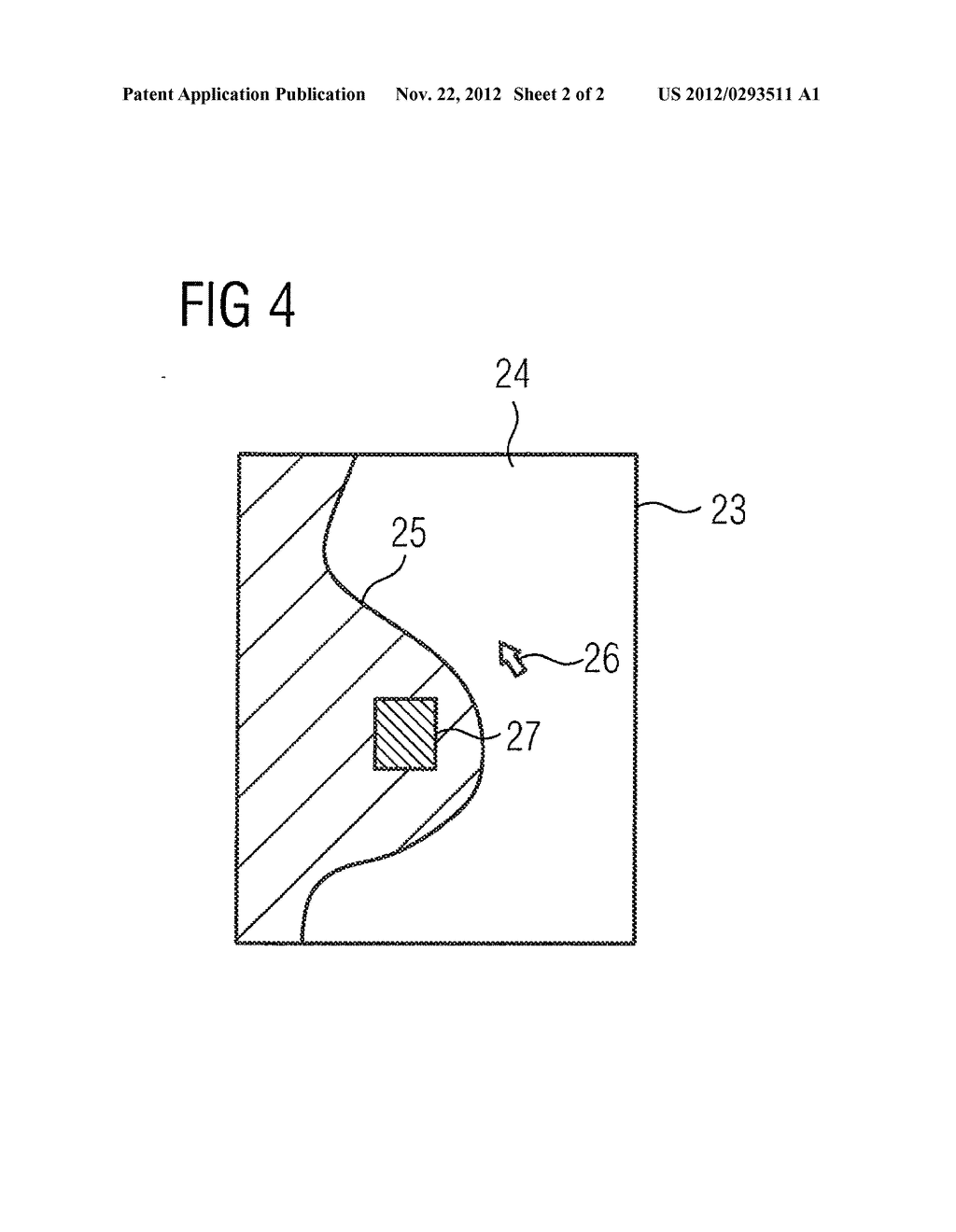 METHOD FOR DISPLAYING AN AREA TO BE MEDICALLY EXAMINED AND/OR TREATED - diagram, schematic, and image 03