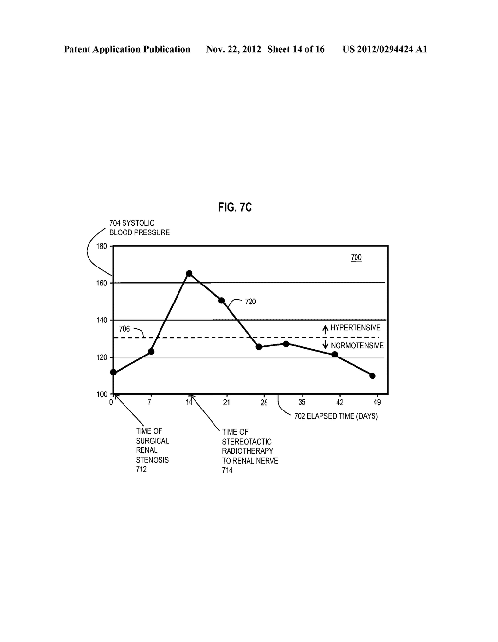 Method And Apparatus for Radioablation of Regular Targets such as     Sympathetic Nerves - diagram, schematic, and image 15