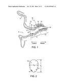 Tool For Insertion and Removal of In-Canal Hearing Devices diagram and image